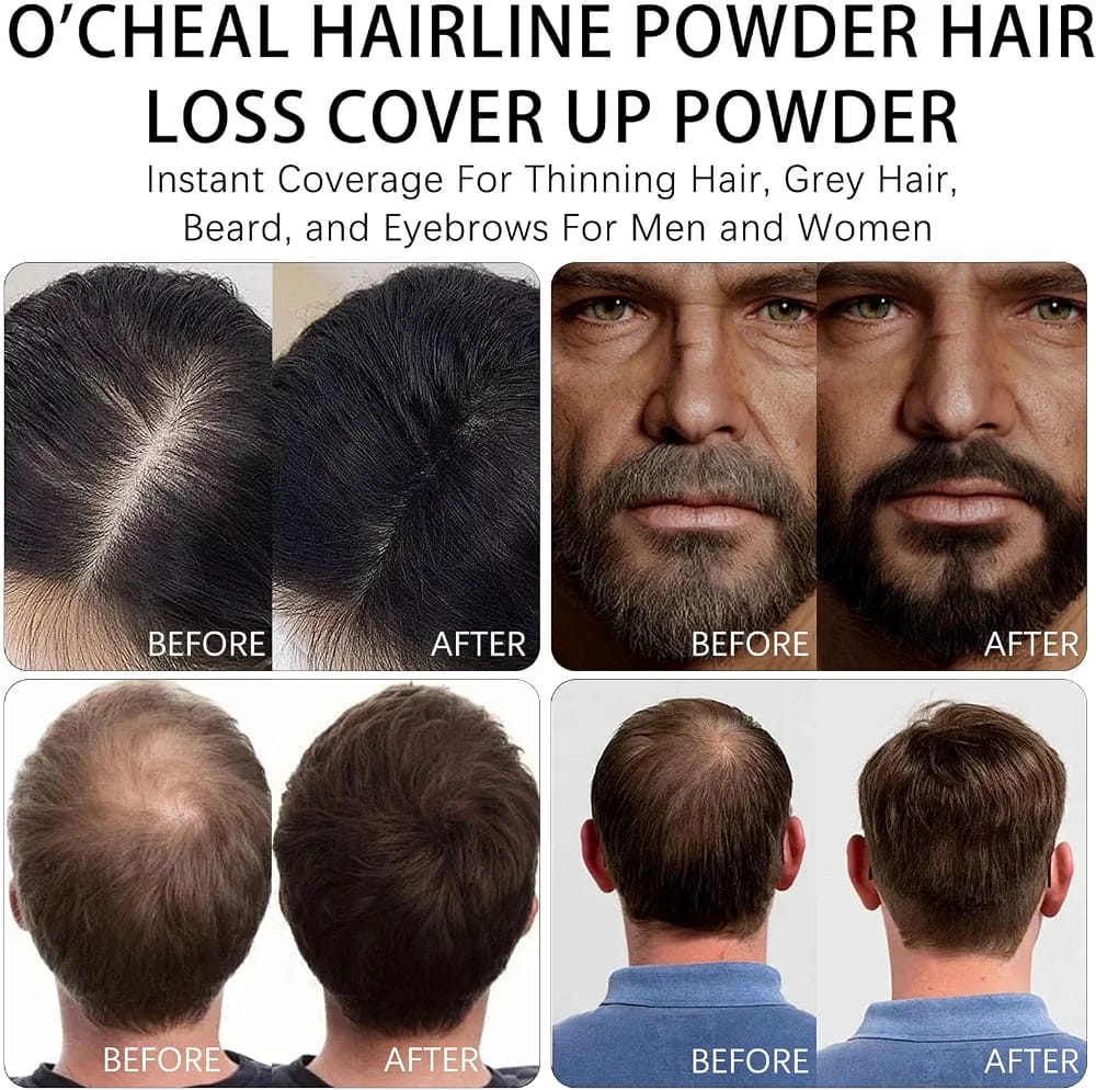 HairLine Magic (water proof 💦)
